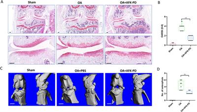 AFK-PD alleviated osteoarthritis progression by chondroprotective and anti-inflammatory activity 